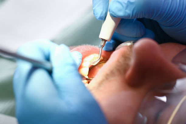 Best Emergency Treatment for Oral Infections in Horatio, AR